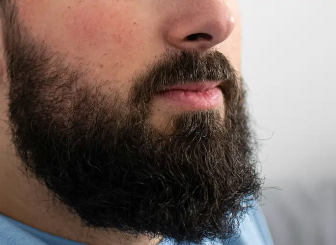 Minoxidil barbe : est-ce que ça marche vraiment ?